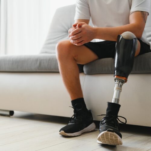 Man amputee with prosthetic leg disability on above knee transfemoral leg prosthesis wearing shoe sitting on sofa, close up. People with amputation disabilities everyday life concept.