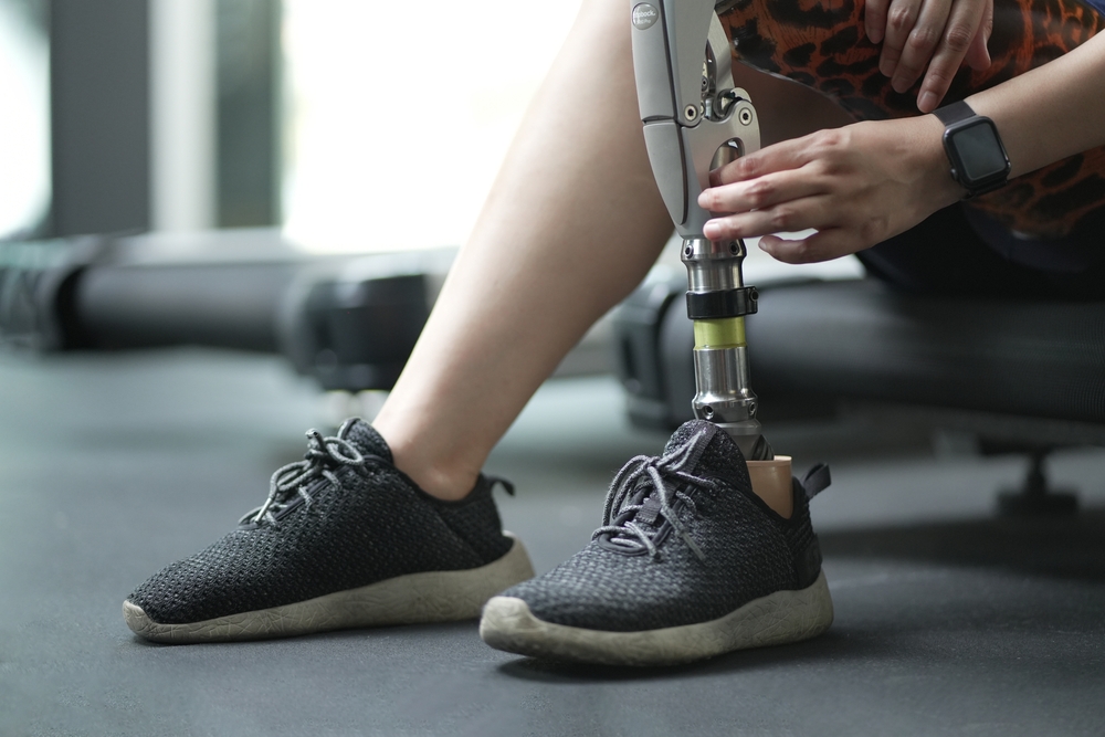 prosthetic, artificial leg. Woman with prosthetic leg using walking on treadmill while working out in gym. artificial leg. Woman wearing prosthetic equipment sit down after exercising in gym. 